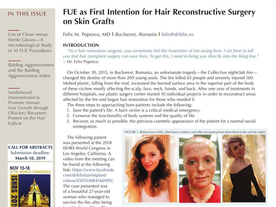 hair transplant forum international